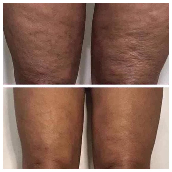 ageLOC® Dermatic Effects™ Body Contouring Lotion/Hibiscus Firming Cream - Picture 5 of 10